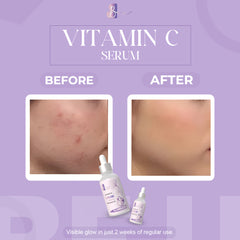 Vitamin C  Brightening Glow Serum